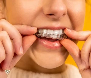 ارتودنسی نامرئی چیست؟ انواع، هزینه، مزایا و محدودیت‌ها (راهنمای جامع ۱۴۰۵)
