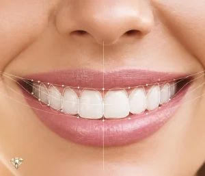 طراحی لبخند چیست؟ روش‌ها، مراحل، هزینه و ماندگاری