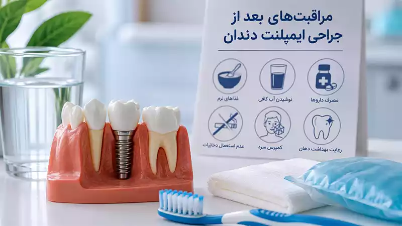 Post-operative-care-for-dental-implants